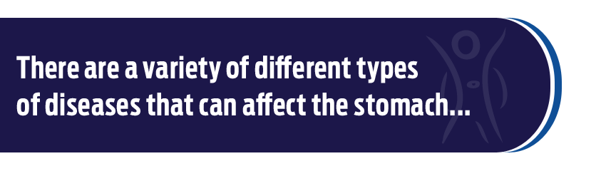 Cirugía de Estómago